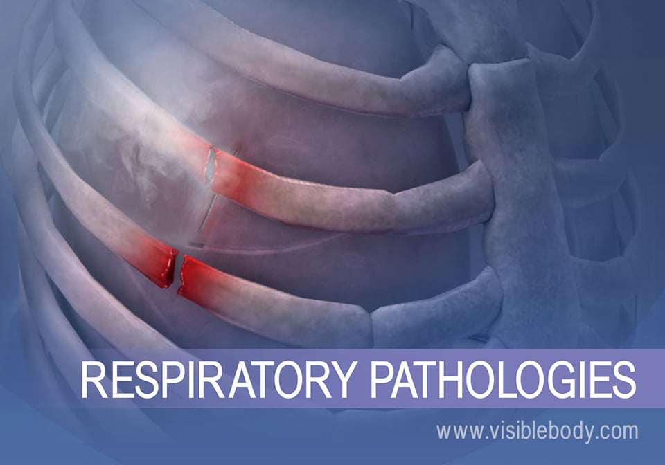 Common respiratory issues range from collapsed lung (pictured) to bronchitis, asthma, and others