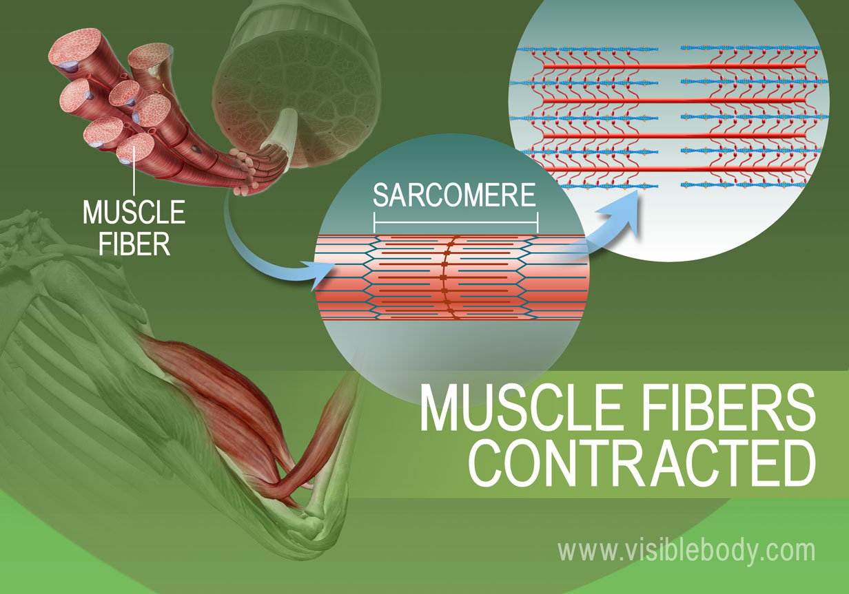 Contracted state of sarcomere