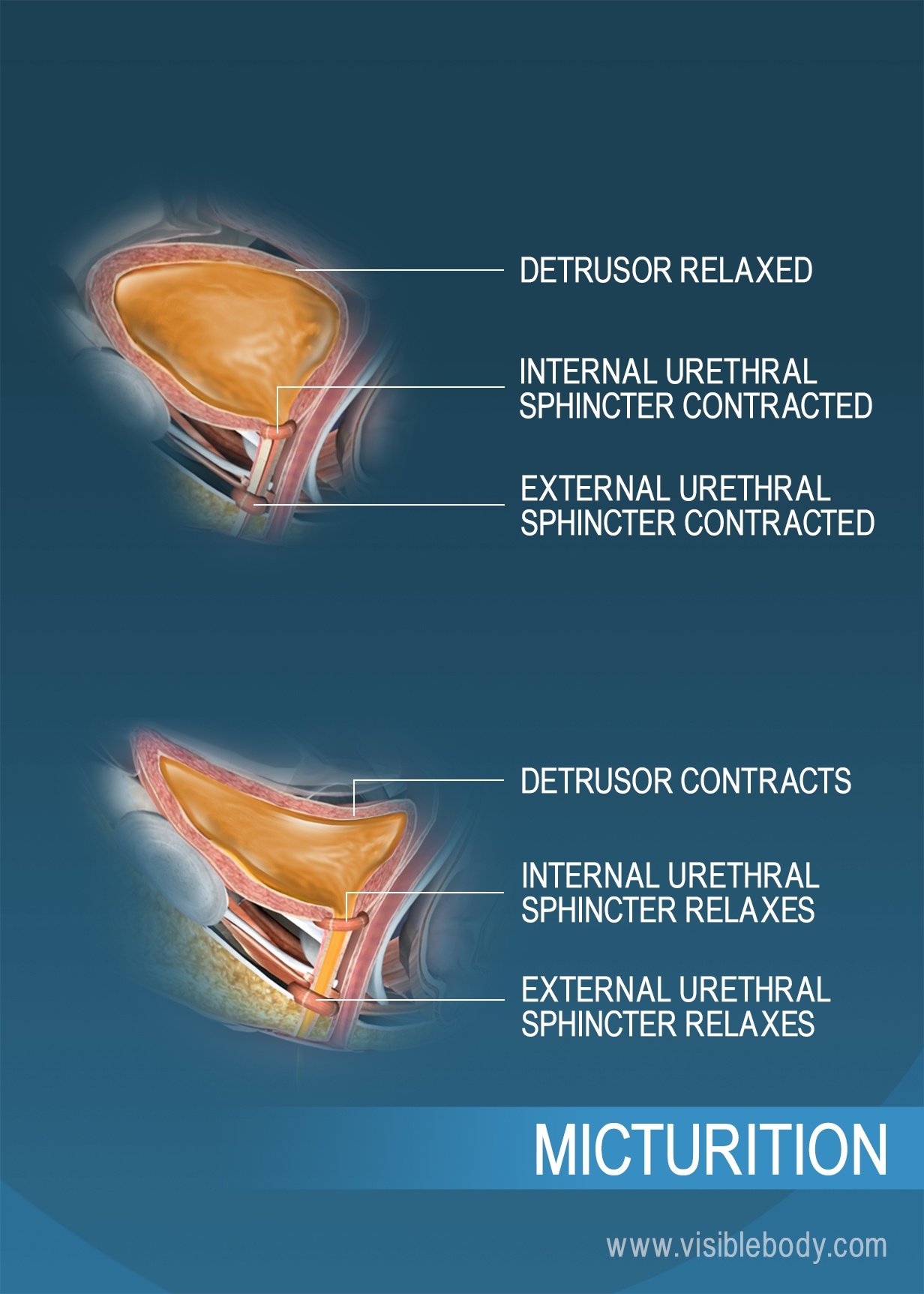 A bladder storing urine, and a bladder in the process of urination, with the urethral sphincters and detrusors acting to facilitate the process